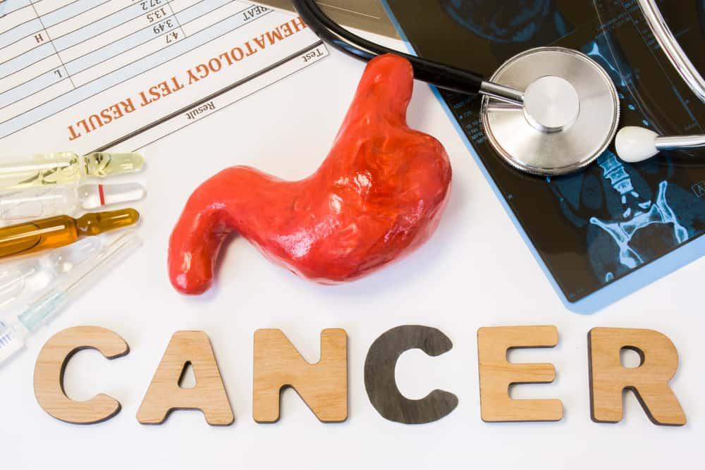 အစာအိမ်ကင်ဆာ (gastric cancer)