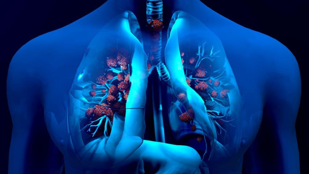 respiratory-infections