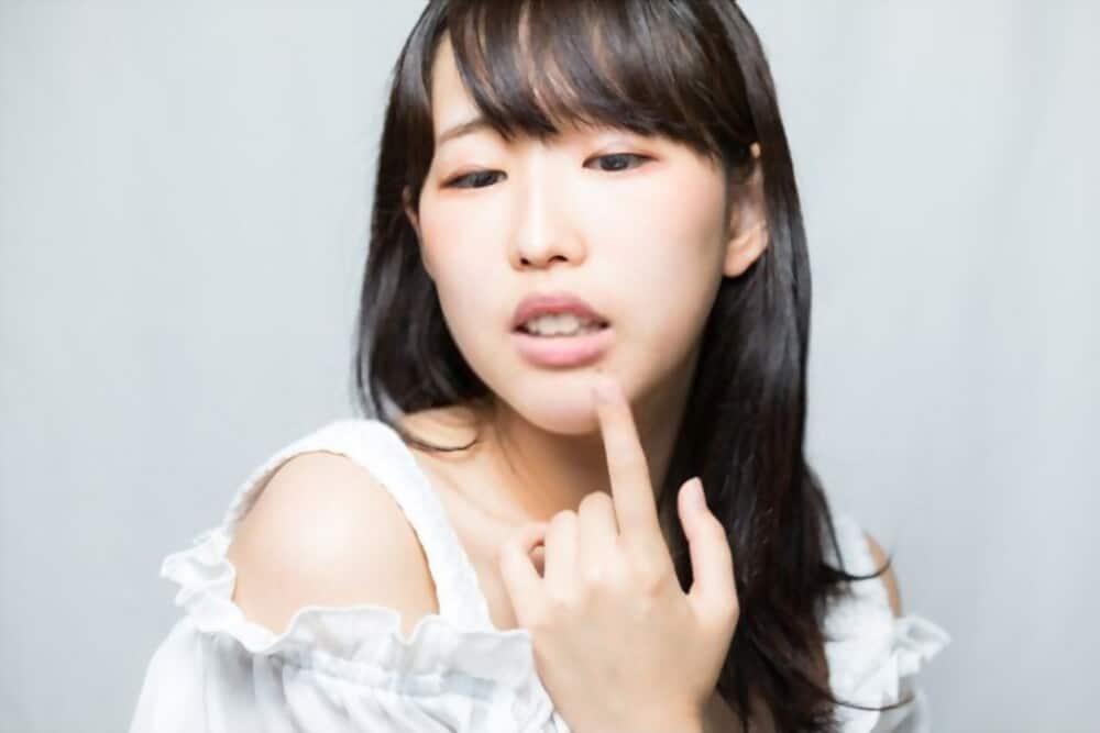 vitamin-b12-and-angular-cheilitis