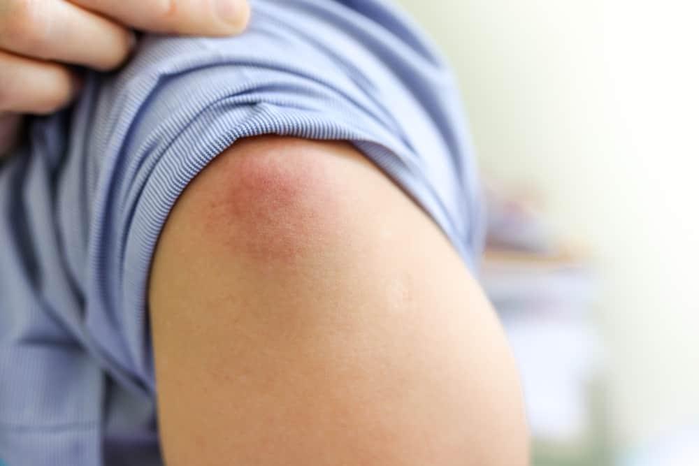 side-effects-of-covid-vaccine