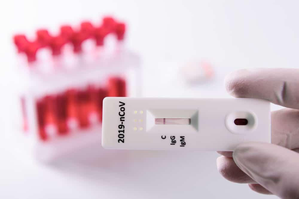 antibody-test-kit-igg-igm