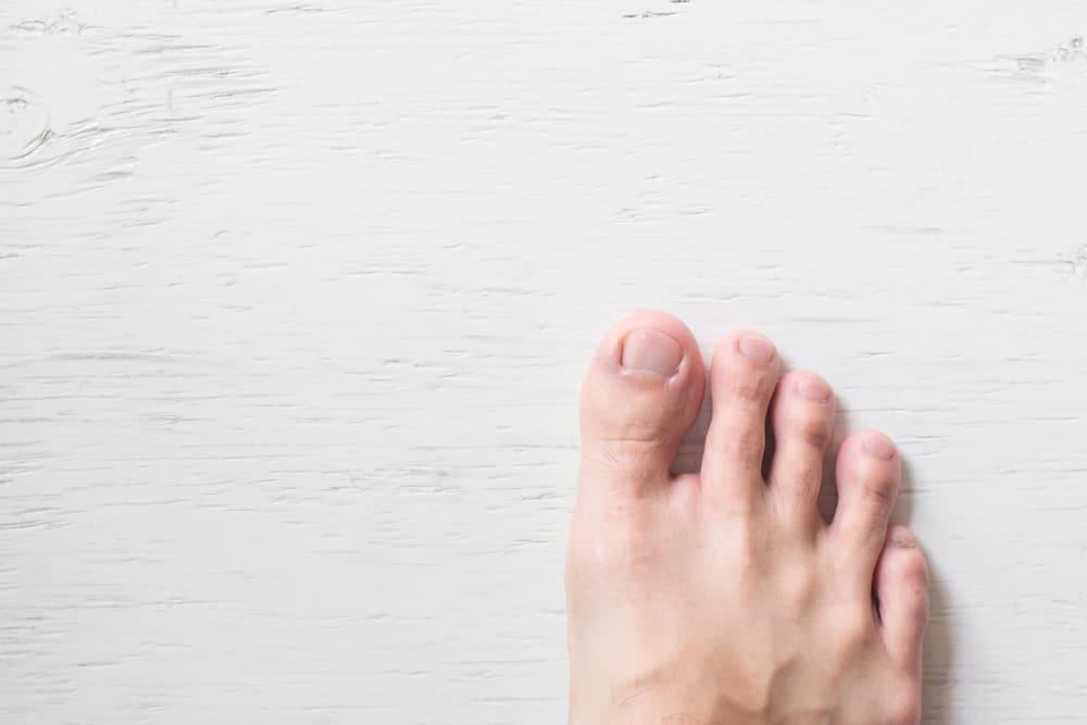 causes-of-ingrown-nails