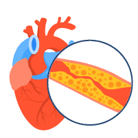 သွေးကြောတွင်းအဆီများခြင်းနောက်ဆက်တွဲပြဿနာများ