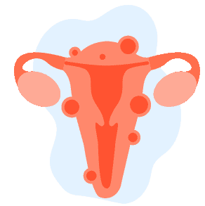 မိန်းမကိုယ်ရောင်ရမ်းခြင်း