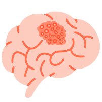 ဦးနှောက်ကင်ဆာကျိတ်များ