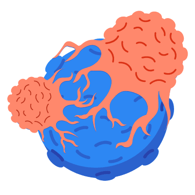 ကင်ဆာရောဂါများ