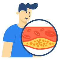 ကိုလက်စထရောလ်