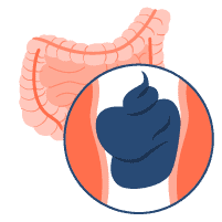 ဝမ်းချုပ်ခြင်း