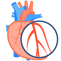 နှလုံးသွေးကြောကျဉ်းရောဂါများ