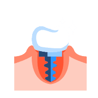 သွားအလှပြုပြင်ခြင်း