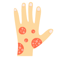 အရေပြားရောင်ရမ်းခြင်းများ