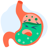 အစားအသောက်မှကူးစက်သောရောဂါများ