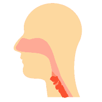 ဦးခေါင်းနှင့်လည်ပင်းဆိုင်ရာကင်ဆာများ