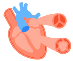 နှလုံးအဆို့ရှင်ရောဂါများ