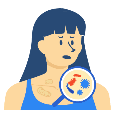 ကူးစက်ရောဂါများ