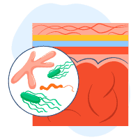 ဦးနှောက်အမြှေးရောင်ခြင်း