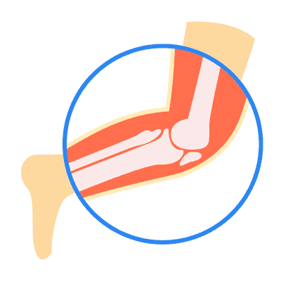 အရိုးအဆစ်နဲ့ကြွက်သားကျန်းမာရေး
