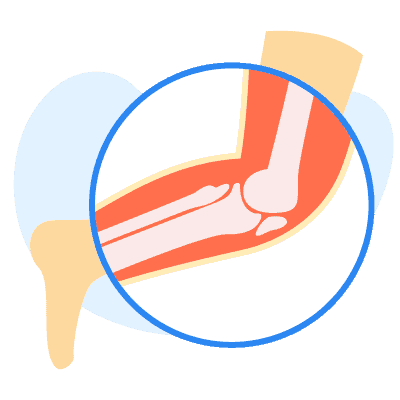 အရိုးအဆစ်နဲ့ကြွက်သားကျန်းမာရေး