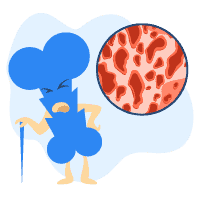 အရိုးပွခြင်း