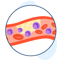သွေးဥမွှားရောဂါများ