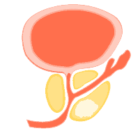 ဆီးကျိတ်ကင်ဆာ