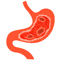 အစာအိမ်အနာ