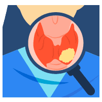 လည်ပင်းသိုင်းရွိုက်ကင်ဆာ