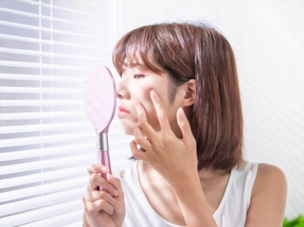 natural-skin-care-routine-for-acne-scars