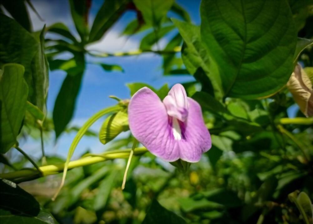 is-it-normal-to-have-dark-private-areas