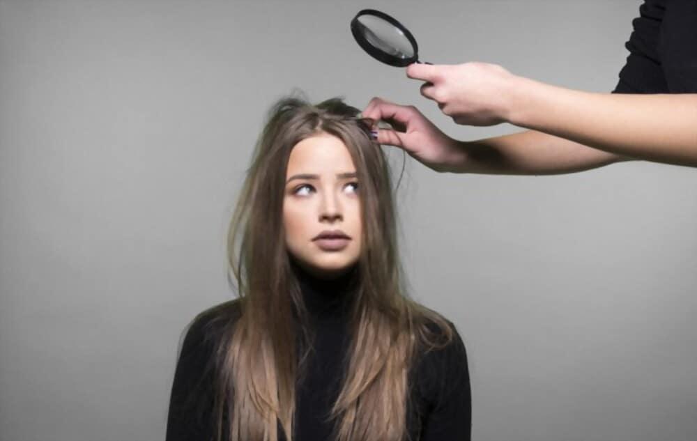 foods-to-eat-to-avoid-dandruff