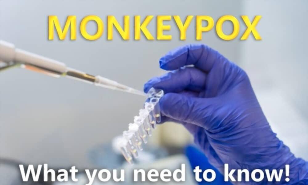 about-monkeypox