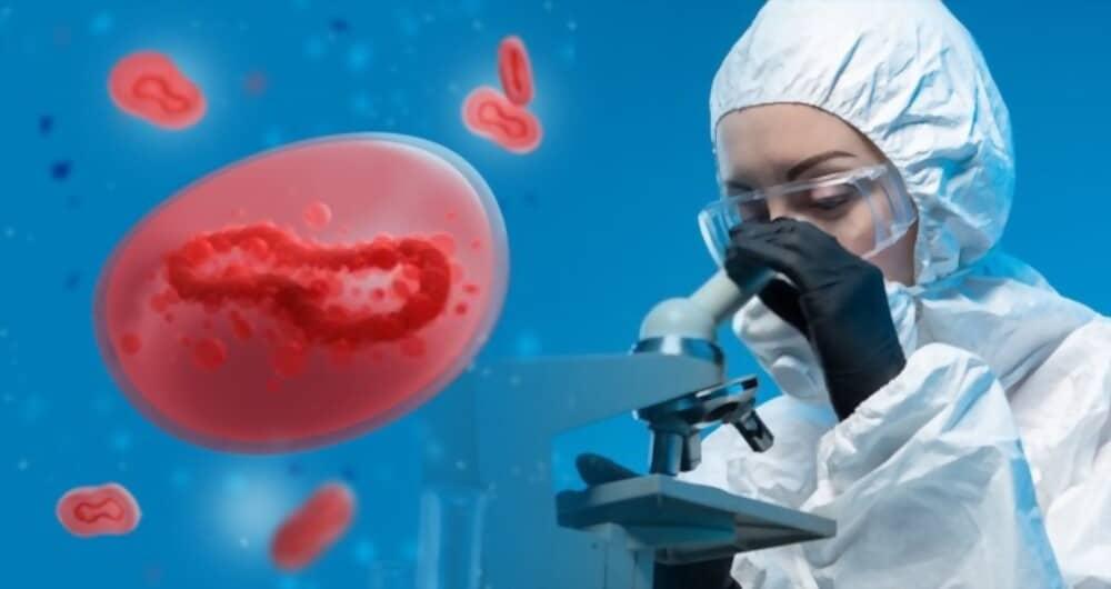 chickenpox-vs-monkeypox