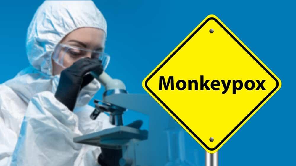 do-you-need-to-concern-monkeypox