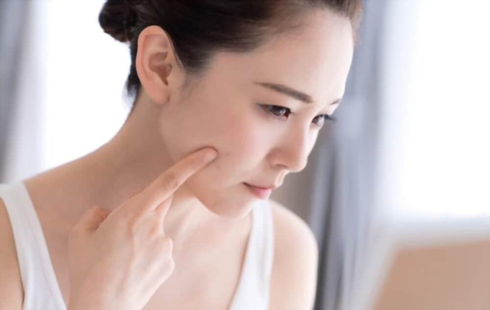 why-sleep-deprivation-causes-acne